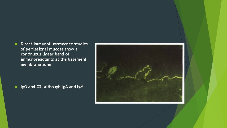 Direct immunofluorescence studies of perilesional mucosa show a continuous linear band of immunoreactants Direct immunofluorescence studies of perilesional mucosa show a continuous linear band of immunoreactants