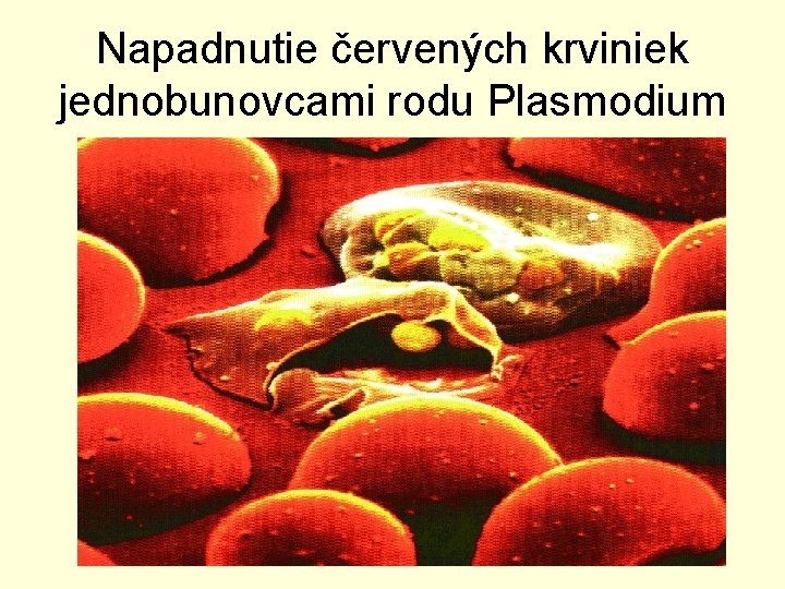 Napadnutie červených krviniek jednobunovcami rodu Plasmodium 