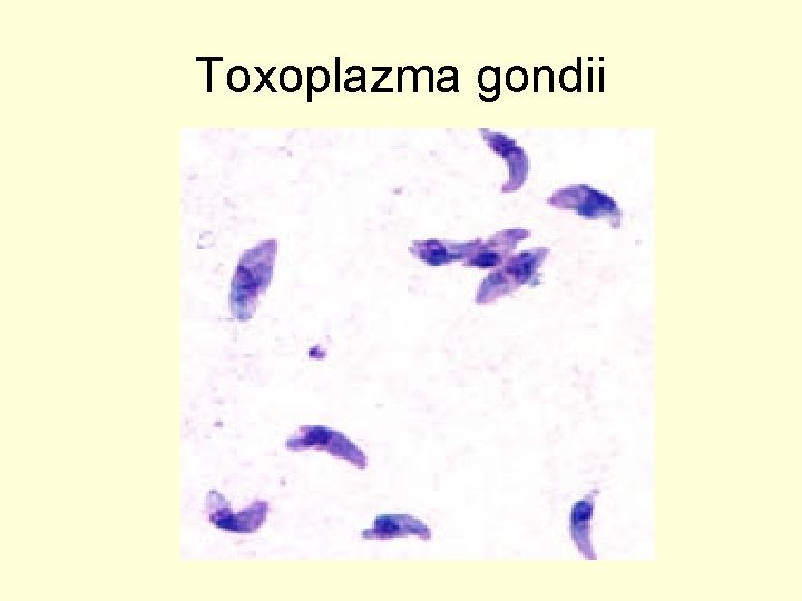 Toxoplazma gondii 