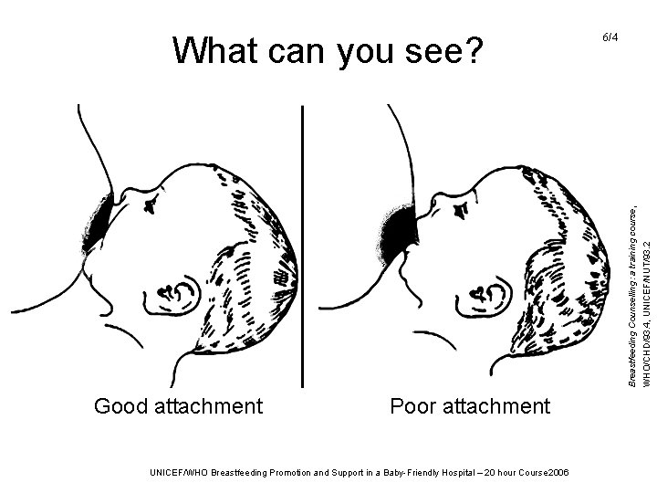 Good attachment Poor attachment UNICEF/WHO Breastfeeding Promotion and Support in a Baby-Friendly Hospital – Good attachment Poor attachment UNICEF/WHO Breastfeeding Promotion and Support in a Baby-Friendly Hospital –