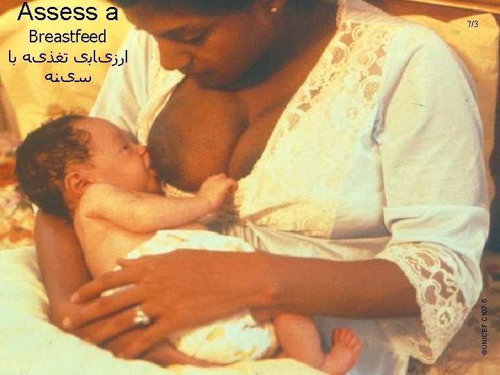 Assess a ©UNICEF C 107 -5 Breastfeed ﺍﺭﺯیﺎﺑی ﺗﻐﺬیﻪ ﺑﺎ ﺳیﻨﻪ 7/3 UNICEF/WHO Breastfeeding Assess a ©UNICEF C 107 -5 Breastfeed ﺍﺭﺯیﺎﺑی ﺗﻐﺬیﻪ ﺑﺎ ﺳیﻨﻪ 7/3 UNICEF/WHO Breastfeeding