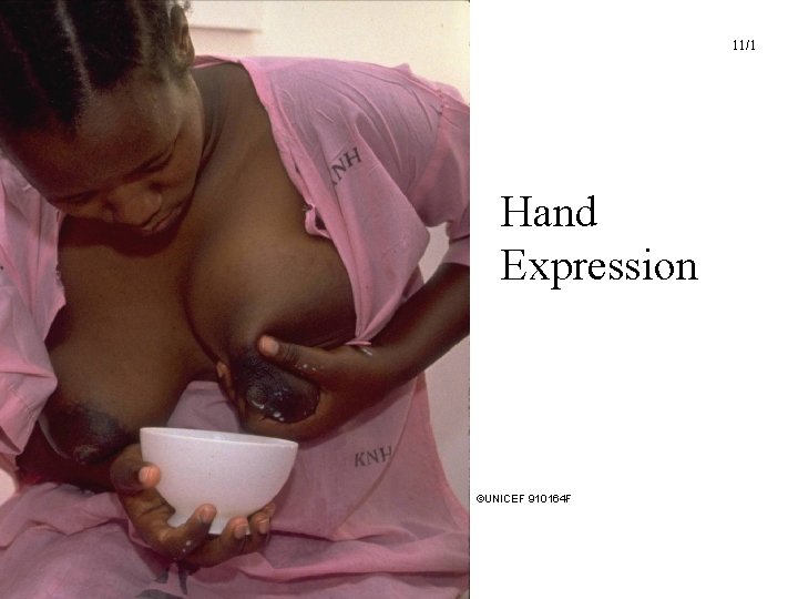 11/1 Hand Expression ©UNICEF 910164 F UNICEF/WHO Breastfeeding Promotion and Support in a Baby-Friendly 11/1 Hand Expression ©UNICEF 910164 F UNICEF/WHO Breastfeeding Promotion and Support in a Baby-Friendly