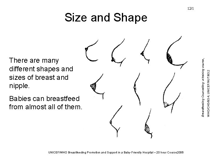 12/1 Babies can breastfeed from almost all of them. UNICEF/WHO Breastfeeding Promotion and Support 12/1 Babies can breastfeed from almost all of them. UNICEF/WHO Breastfeeding Promotion and Support