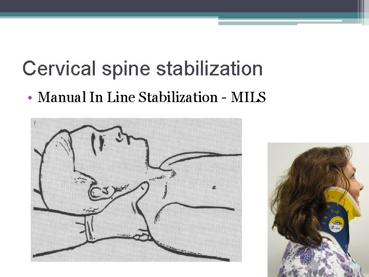 Cervical spine stabilization • Manual In Line Stabilization - MILS 