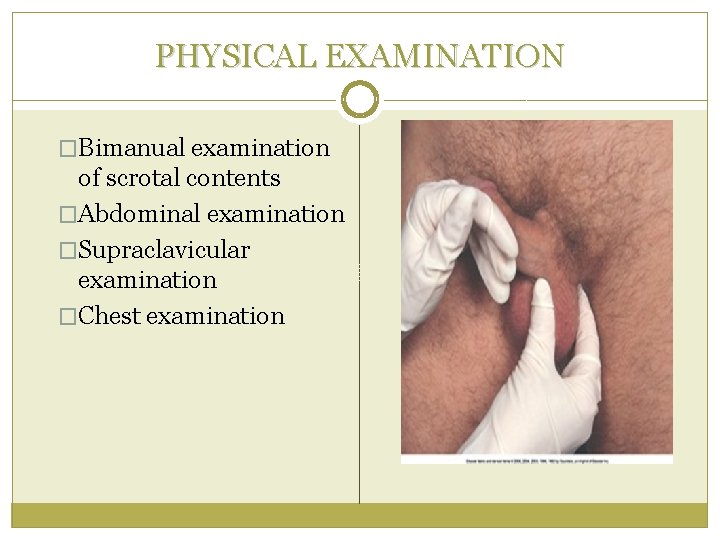 PHYSICAL EXAMINATION �Bimanual examination of scrotal contents �Abdominal examination �Supraclavicular examination �Chest examination 