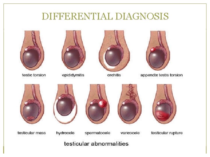 DIFFERENTIAL DIAGNOSIS 