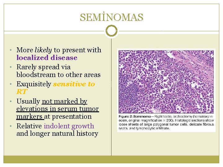 SEMİNOMAS • More likely to present with • • localized disease Rarely spread via