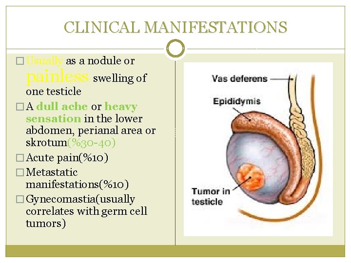 CLINICAL MANIFESTATIONS � Usually as a nodule or painless swelling of one testicle �