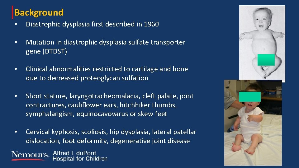 Background • Diastrophic dysplasia first described in 1960 • Mutation in diastrophic dysplasia sulfate