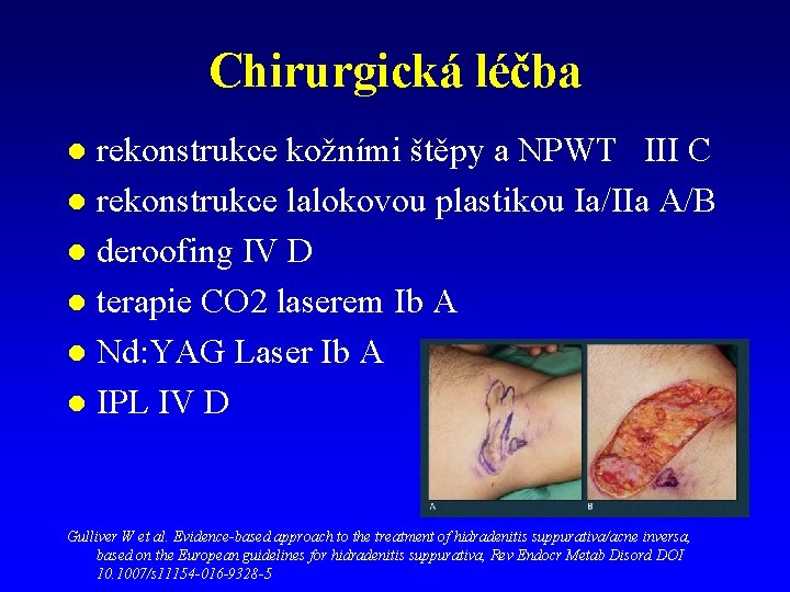 Chirurgická léčba rekonstrukce kožními štěpy a NPWT III C l rekonstrukce lalokovou plastikou Ia/IIa Chirurgická léčba rekonstrukce kožními štěpy a NPWT III C l rekonstrukce lalokovou plastikou Ia/IIa