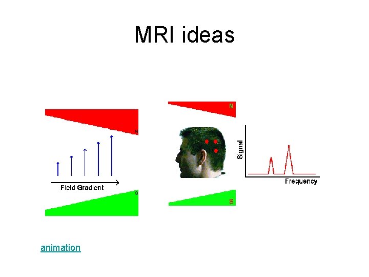 MRI ideas animation MRI ideas animation