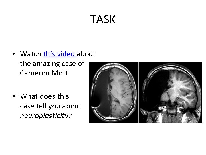 TASK • Watch this video about the amazing case of Cameron Mott • What