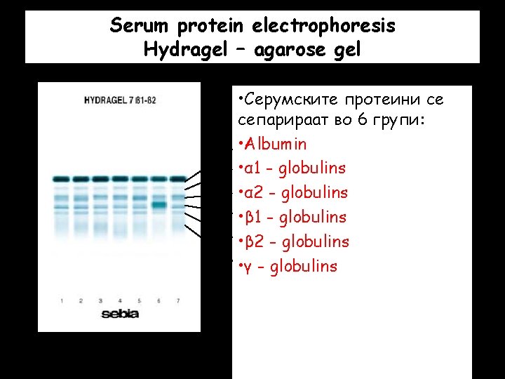 Serum protein electrophoresis Hydragel – agarose gel • Серумските протеини се сепарираат во 6