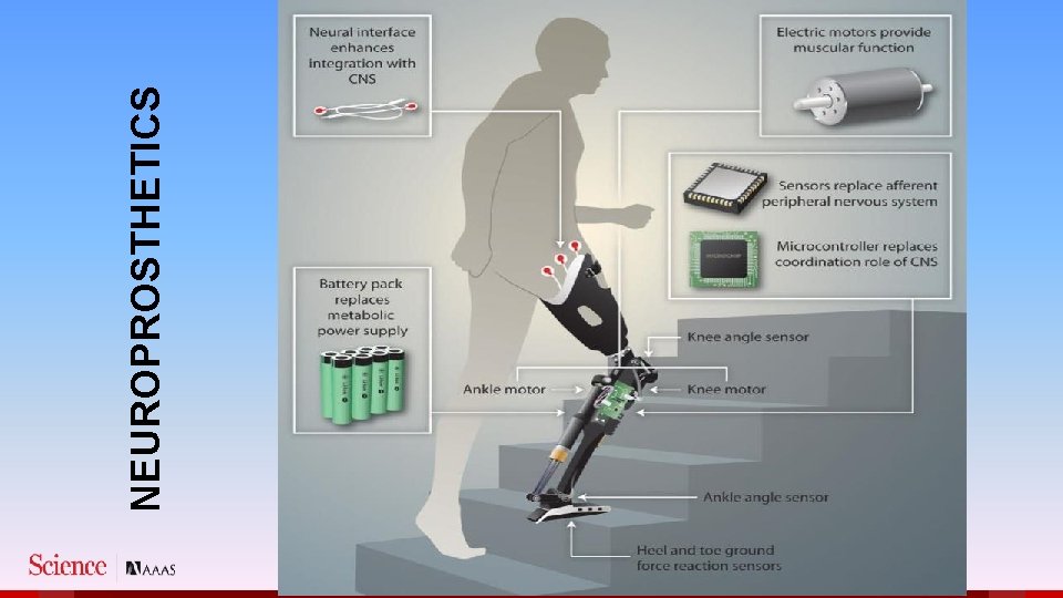 NEUROPROSTHETICS 