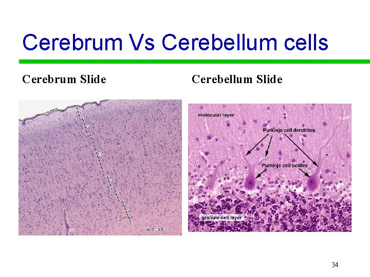 Cerebrum Vs Cerebellum cells Cerebrum Slide Cerebellum Slide 34 