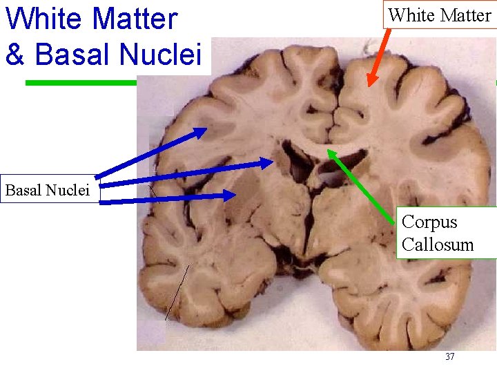 White Matter & Basal Nuclei White Matter Basal Nuclei Corpus Callosum 37 