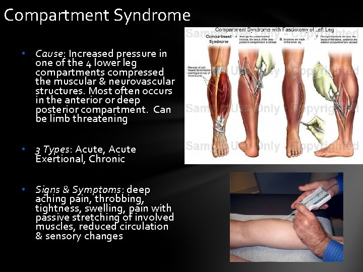 Compartment Syndrome • Cause: Increased pressure in one of the 4 lower leg compartments