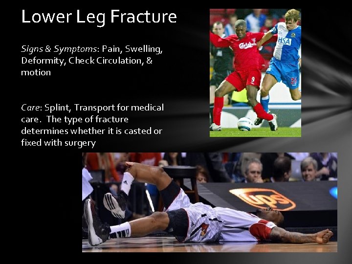 Lower Leg Fracture Signs & Symptoms: Pain, Swelling, Deformity, Check Circulation, & motion Care: