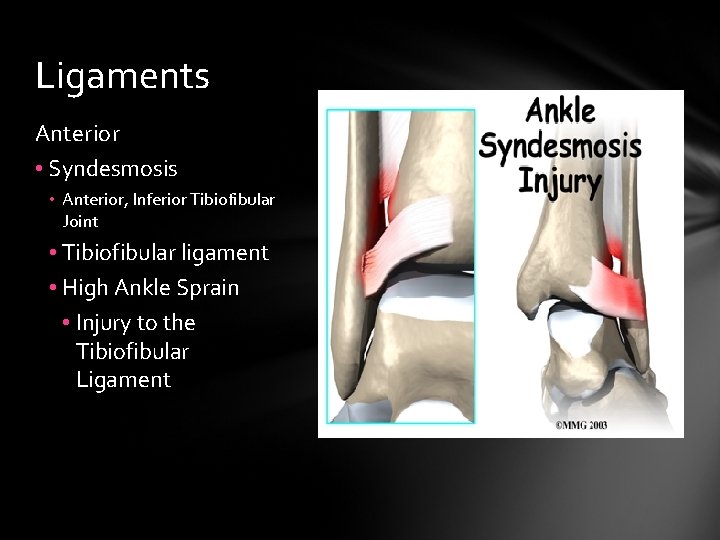 Ligaments Anterior • Syndesmosis • Anterior, Inferior Tibiofibular Joint • Tibiofibular ligament • High
