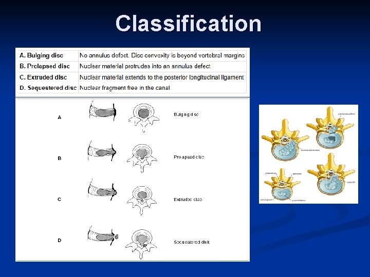 Classification Classification