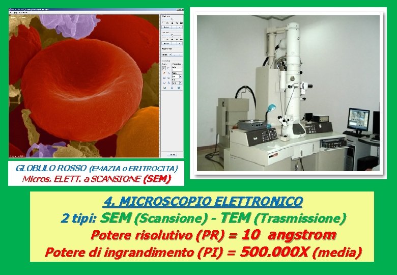 GLOBULO ROSSO (EMAZIA o ERITROCITA) Micros. ELETT. a SCANSIONE (SEM) 4. MICROSCOPIO ELETTRONICO 2