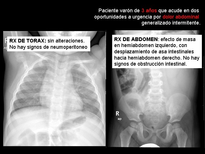 Paciente varón de 3 años que acude en dos oportunidades a urgencia por dolor