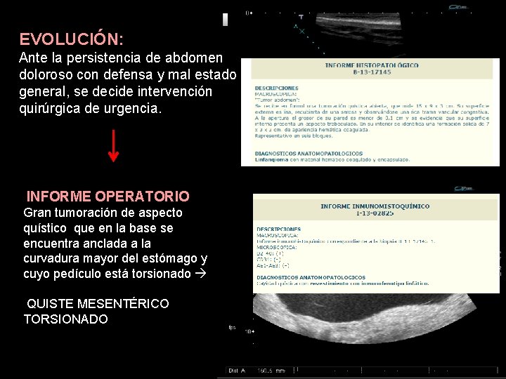 2. ¿ Tomando en cuenta los EVOLUCIÓN: hallazgos ecográficos, que Ante la persistencia de