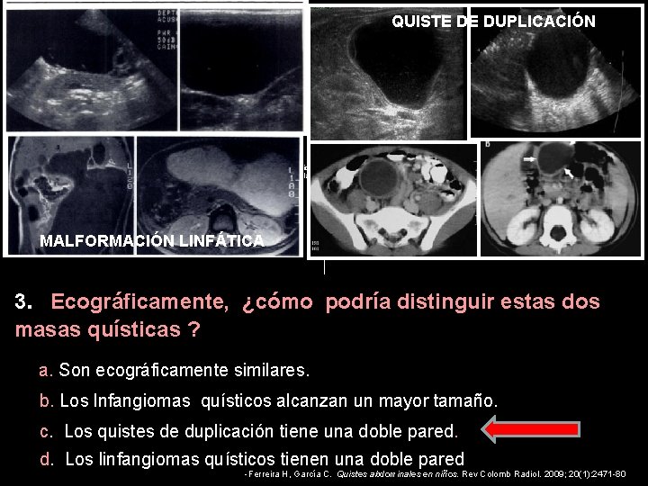 QUISTE DE DUPLICACIÓN QUISTES ABDOMINALES EN NIÑOS HÍGADO Hamartoma mesenquimal Quiste simple congénito RIÑÓN