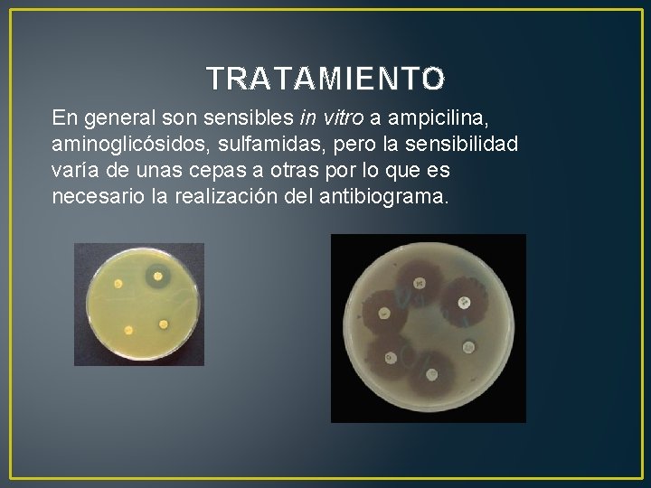 TRATAMIENTO En general son sensibles in vitro a ampicilina, aminoglicósidos, sulfamidas, pero la sensibilidad