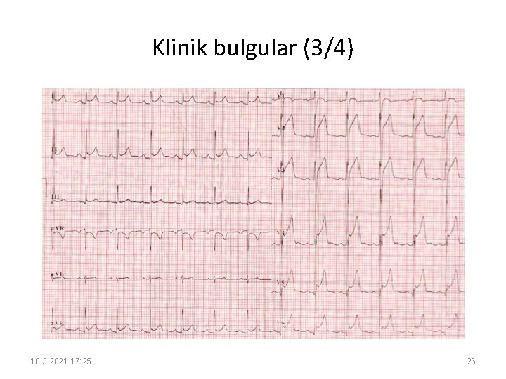 Klinik bulgular (3/4) 10. 3. 2021 17: 25 26 