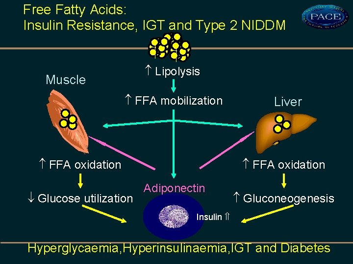 Free Fatty Acids: Insulin Resistance, IGT and Type 2 NIDDM Lipolysis Muscle FFA mobilization