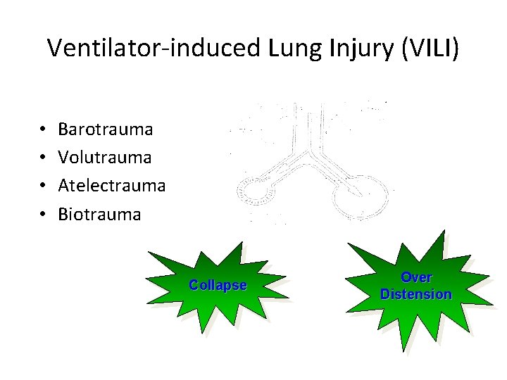 Ventilator-induced Lung Injury (VILI) • • Barotrauma Volutrauma Atelectrauma Biotrauma Collapse Over Distension 