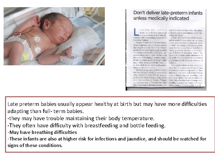 Late preterm babies usually appear healthy at birth but may have more difficulties adapting