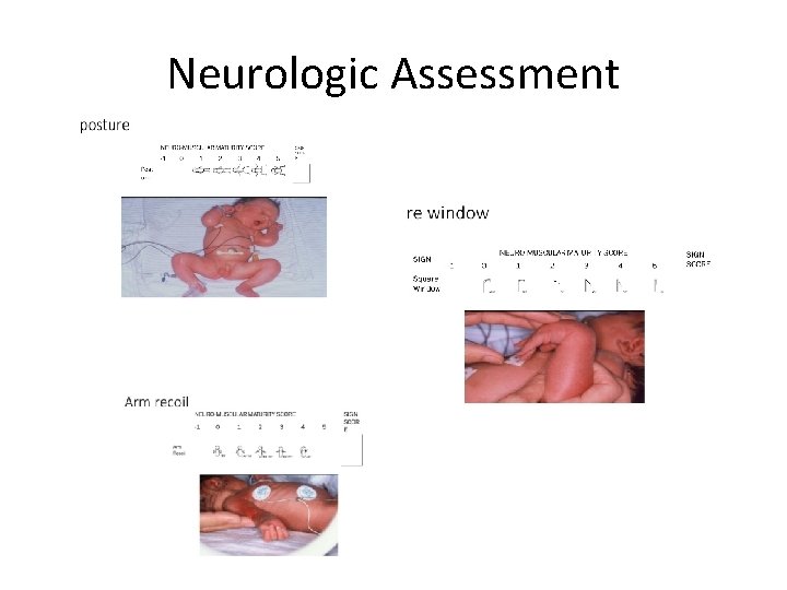 Neurologic Assessment 