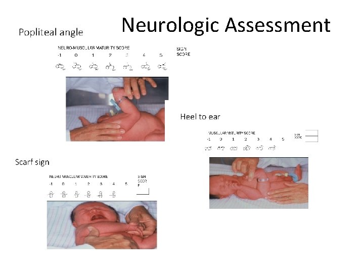 Neurologic Assessment 