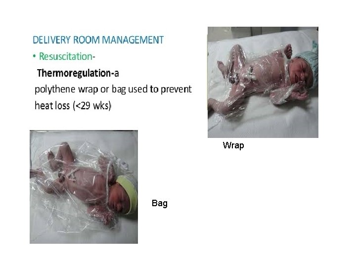 Wrap Bag 