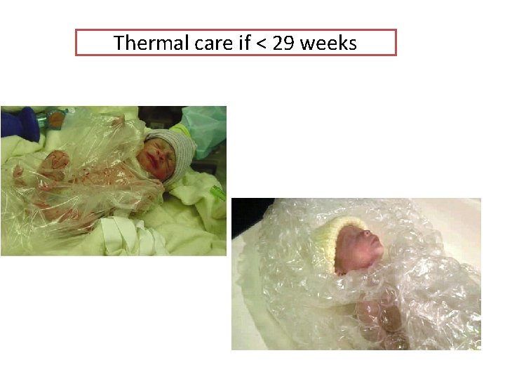 Thermal care if < 29 weeks 