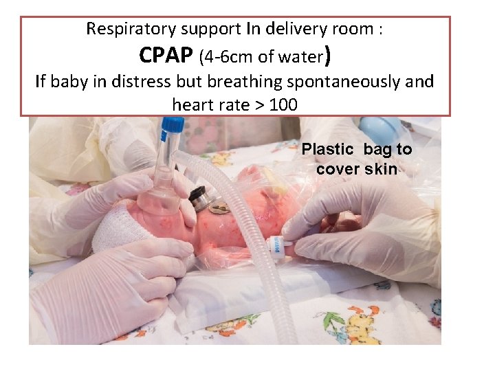 Respiratory support In delivery room : CPAP (4 -6 cm of water) If baby