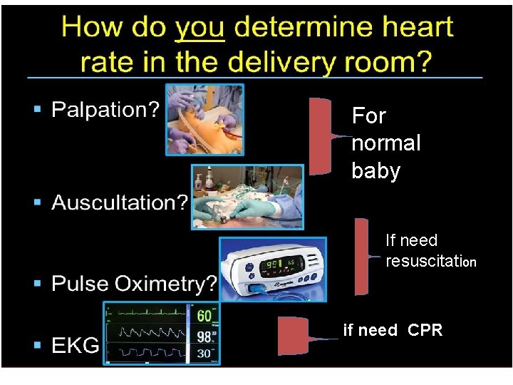 For normal baby If need resuscitation if need CPR 