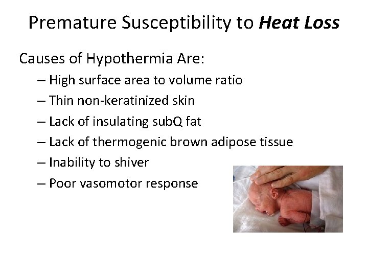Premature Susceptibility to Heat Loss Causes of Hypothermia Are: – High surface area to
