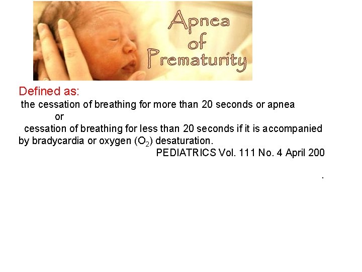 Defined as: the cessation of breathing for more than 20 seconds or apnea or