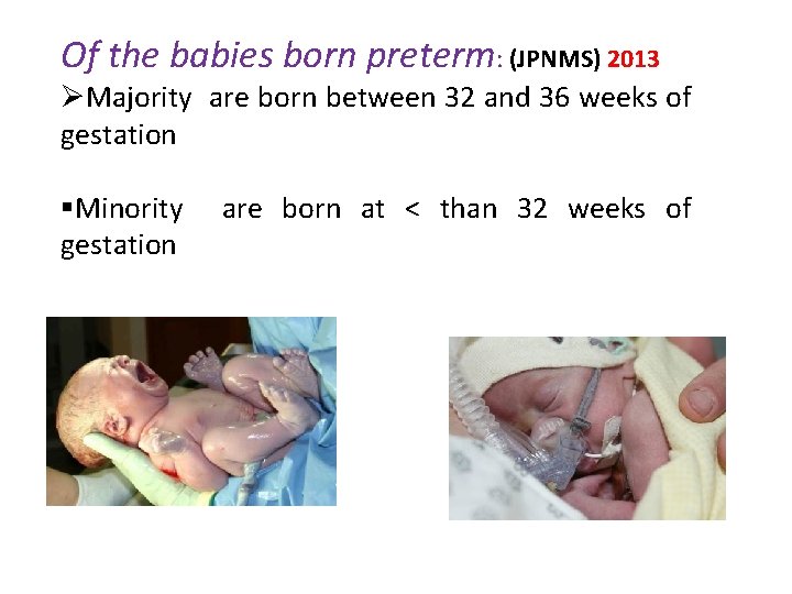 Of the babies born preterm: (JPNMS) 2013 ØMajority are born between 32 and 36