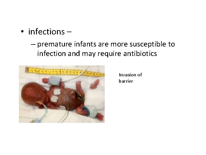  • infections – – premature infants are more susceptible to infection and may