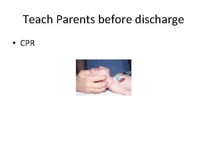 Teach Parents before discharge • CPR 