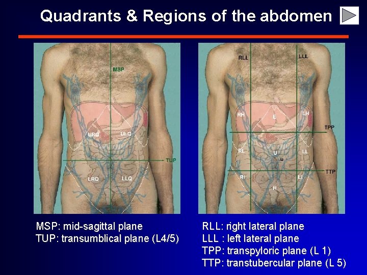Quadrants & Regions of the abdomen MSP: mid-sagittal plane TUP: transumblical plane (L 4/5)