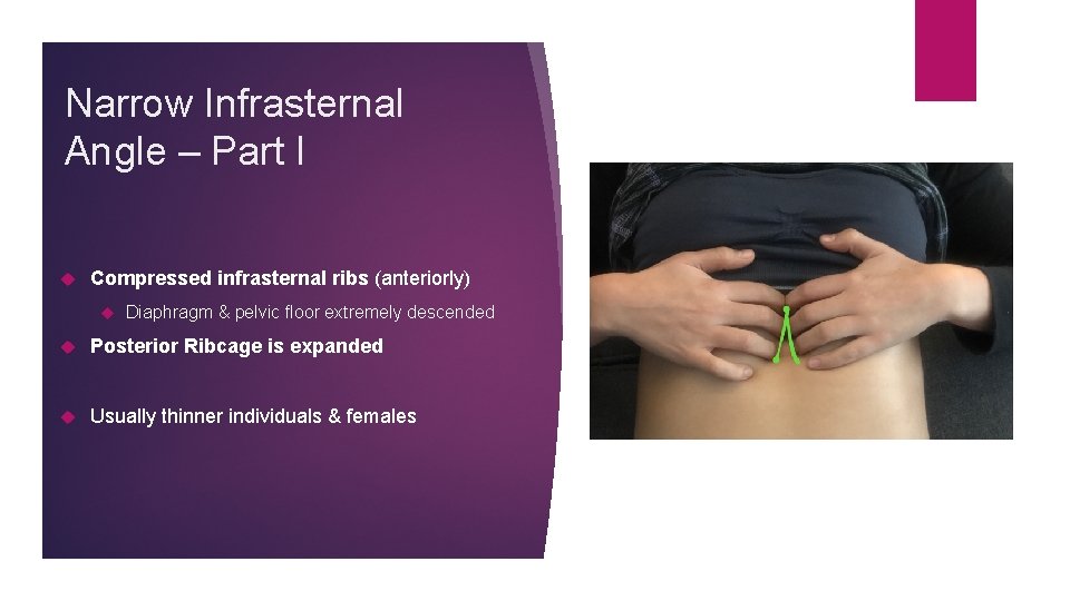 Narrow Infrasternal Angle – Part I Compressed infrasternal ribs (anteriorly) Diaphragm & pelvic floor