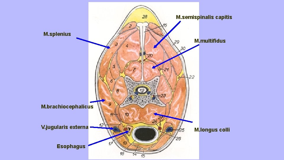 M. semispinalis capitis M. splenius M. multifidus M. brachiocephalicus V. jugularis externa Esophagus M.