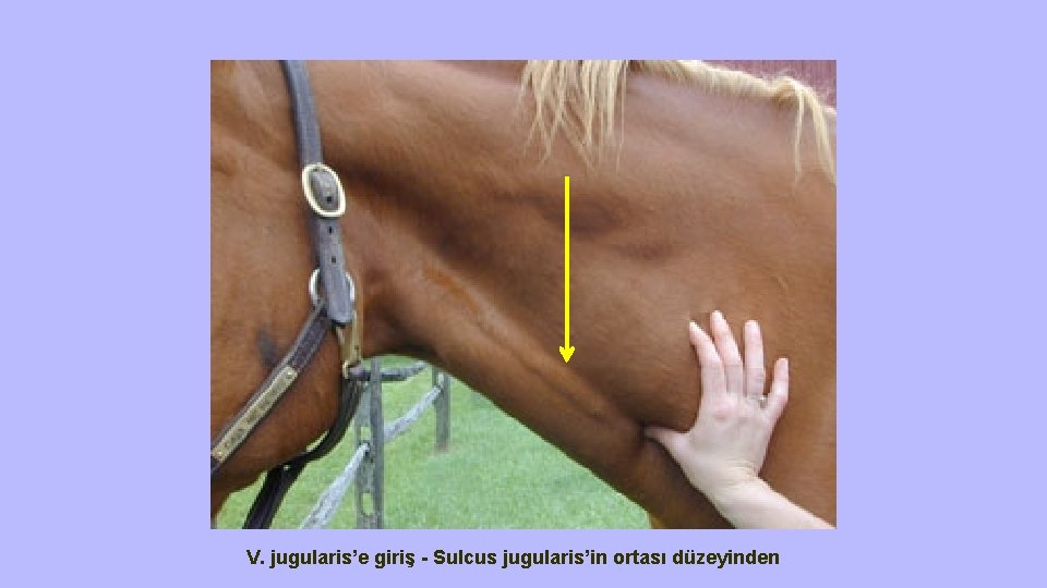 V. jugularis’e giriş - Sulcus jugularis’in ortası düzeyinden 