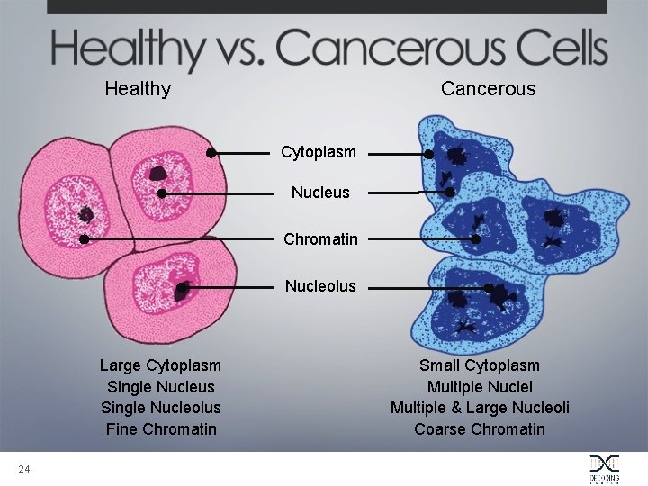 Healthy Cancerous Cytoplasm Nucleus Chromatin Nucleolus Large Cytoplasm Single Nucleus Single Nucleolus Fine Chromatin