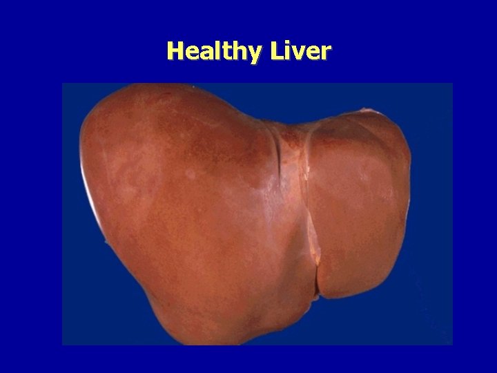 Healthy Liver 